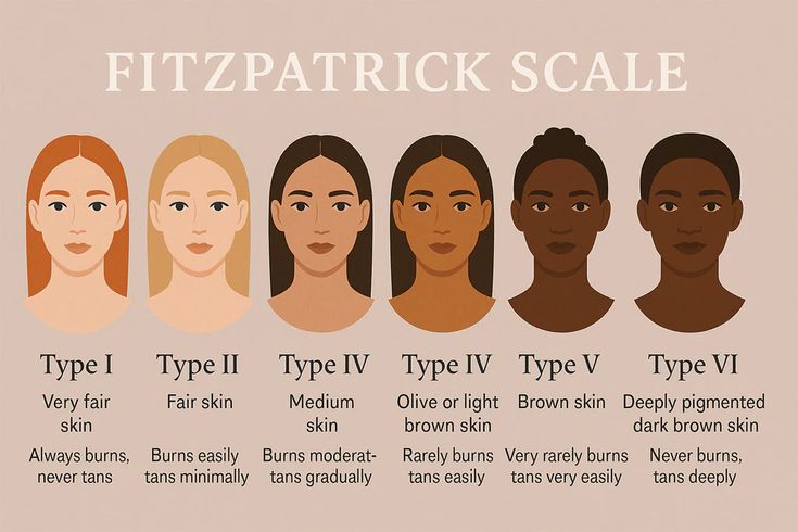 The Fitzpatrick Scale, Types I to VI